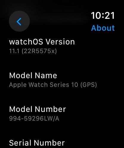 Leaked Apple Watch Series 10 prototype photos.